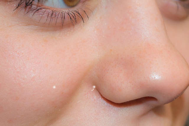 Boutons blancs sur le visage