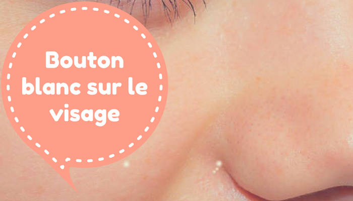 Des boutons blancs sur le visage?